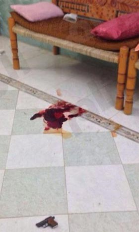 "زوجة رابعة" تطلق النار على نفسها بجازان محاولةً الانتحار 