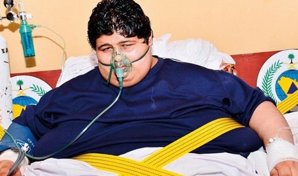 "قاهر السمنة" السعودي يخسر أكثر من نصف وزنه