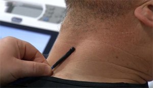 بالفيديو.. فحص دم بدون وخز إبر في ابتكار حديث