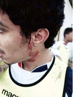 خروج الخياط وتحويل قريب أحد اللاعبين إلى مستشفى الجهراء
