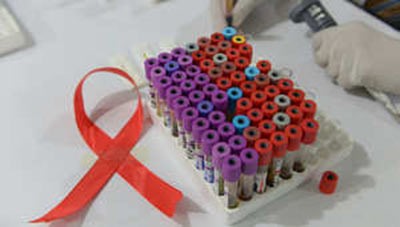 مجموعة من عينات الدم التي تخضع لفحص الايدز