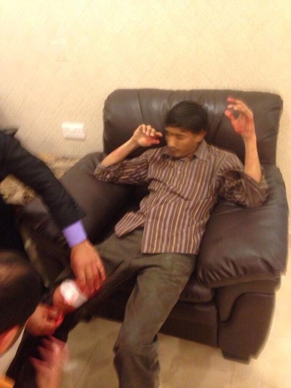 الاسيوي المصاب