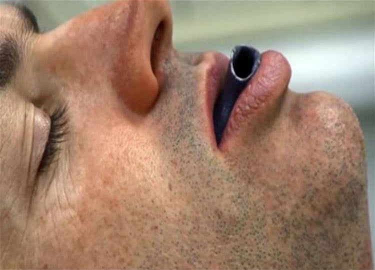 «منقار البطة».. طريقة جديدة لعلاج «الشخير» 