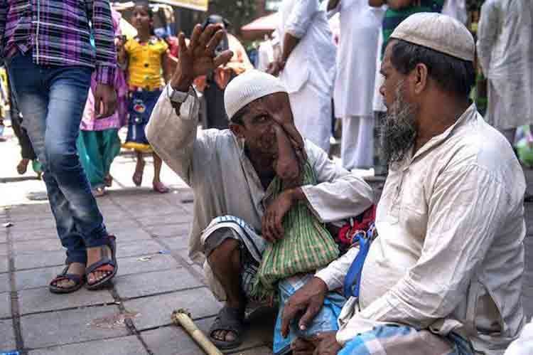 بالصور.. «الرجل المنصهر» يرفض إعانة لإصلاح تشوهات خطيرة بوجهه ليتسول 