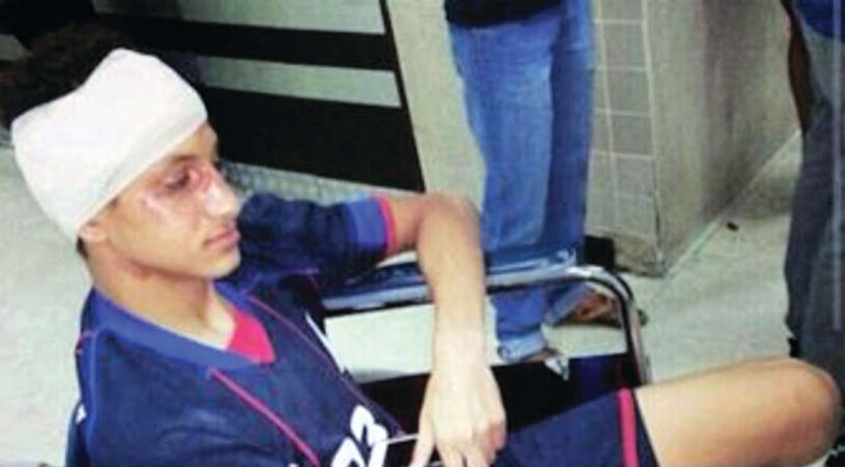 لاعب اليرموك عمرو جمال الدين واثار الضرب واضحة على وجهه وراسه