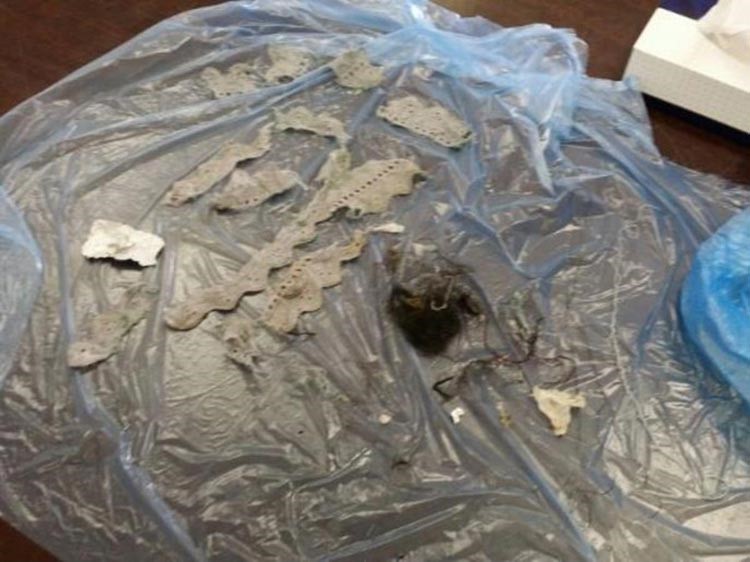بالصور.. فتاة في السعودية تخرج سحراً من بطنها 