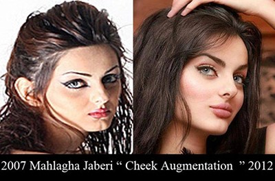 صدمة بالصور: هذا هو شكل الإيرانية أجمل نساء الأرض قبل عمليات التجميل