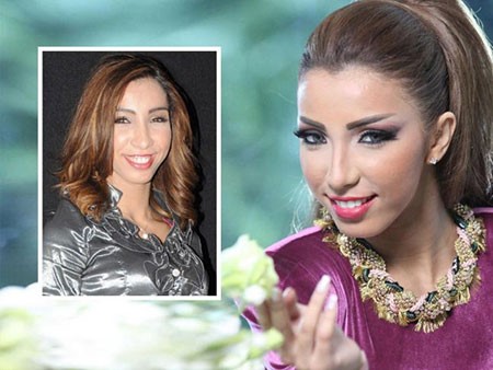دنيا بطمة قبل وبعد عمليات التجميل