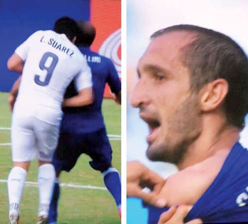 بارع في العض والاعتذار﻿