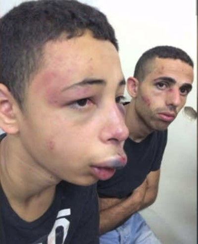 بالفيديو... لحظات مروعة لضرب الطفل الفلسطيني بطريقة وحشية من قبل جيش الاحتلال الإسرائيلي