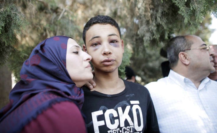 الفتى طارق ابو خضير الاميركي الجنسية الذي تطالب واشنطن بالتحقيق بتعرضه للتعذيب على يد القوات الاسرائيلية 	رويترز ﻿