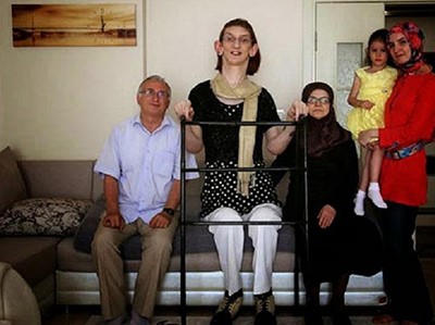 بالصور.. شاهد اطول فتاة في العالم