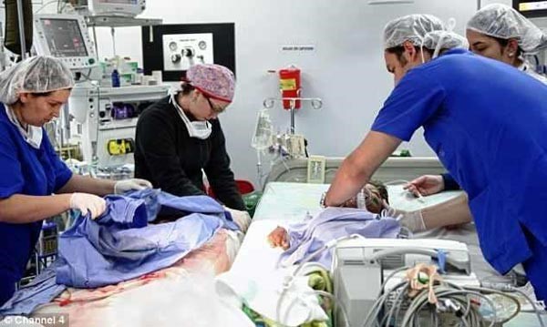 بالصور.. طفل كولومبي يظهر إعلاميًّا لأول مرة بعد استئصال قوقعة سلحفاة من ظهره
