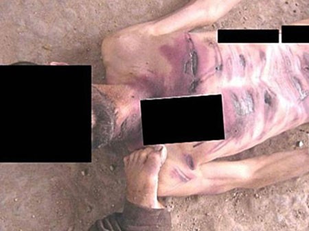 تحذير.. صور مرعبة يقدمها "قيصر" للتعذيب بسجون سورية