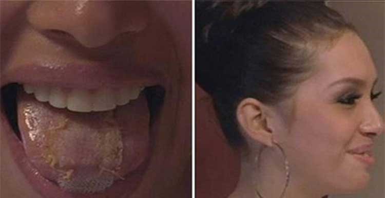 بالصور ..  عارضة أزياء فنزويلية تخيط لسانها للحفاظ على رشاقتها