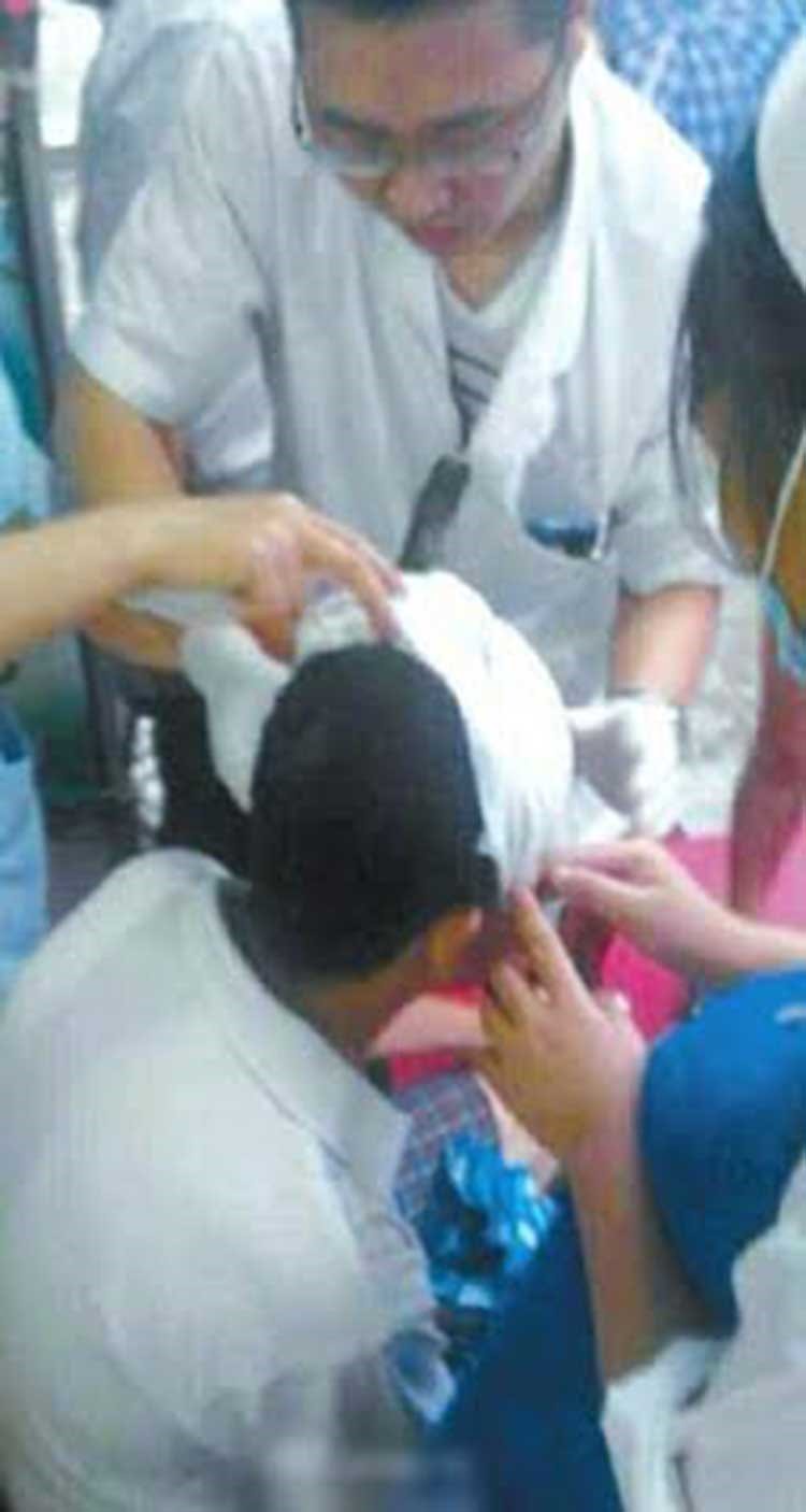 بالصور.. سكين يسقط من الطابق الثامن لينغرس في رأس رجل صيني