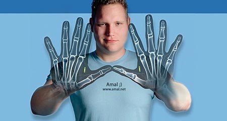 امال جرافسترا-Amal Graafstra لديه رقائق RFID في كفيه