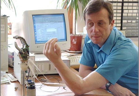 البروفيسور كيفن وارويك Kevin Warwick وزوجته زرعا اجهزة تعمل بالاشتراك بينهما