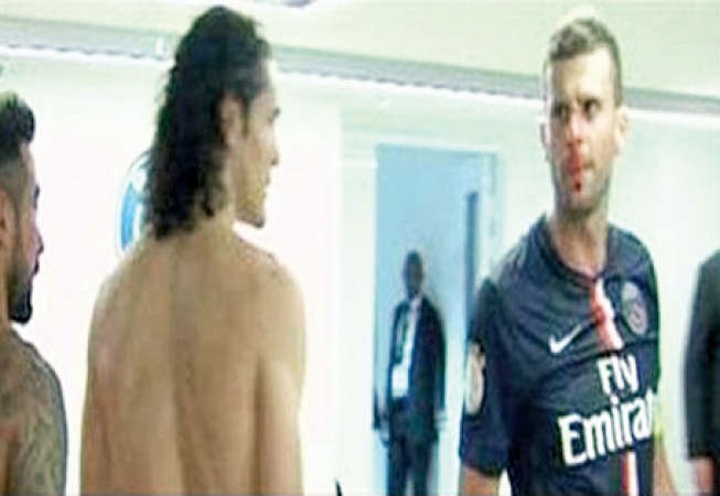 موتا بعد الاصابة