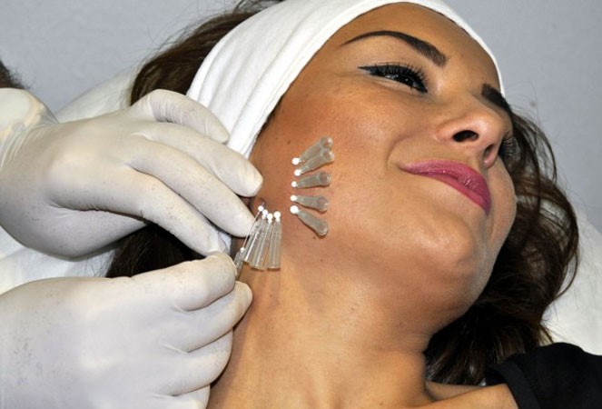 النساء يلجأن للتجميل للمزيد من الجاذبية قبل الزواج