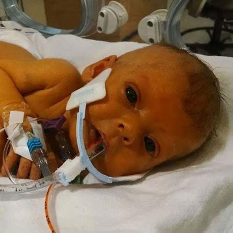 بالصور.. متطوعون "يفزعون" لأب طلب تعديلاً على صورة طفلته الراحلة 
