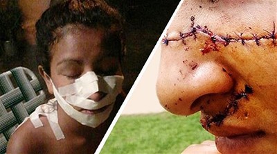 شقيقتان تشوهان وجه فتاة حسناء بسبب الغيرة