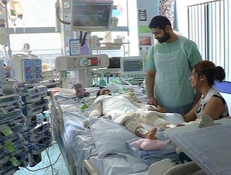 بالصور.. تساقط جلد وشعر فتاة بريطانية بسبب البنسلين