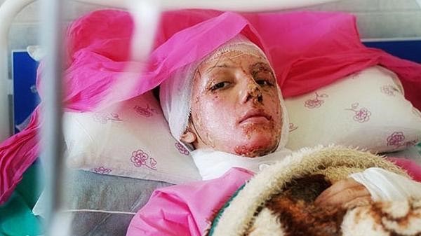 بالصور.. مشاهير السينما الإيرانية يزورون "سهيلا" ضحية الأسيد