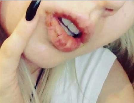 بالصور.. مجهولان يعتديان بالضرب على «باربي» البشرية ويدميانها