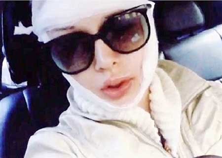 بالصور.. مجهولان يعتديان بالضرب على «باربي» البشرية ويدميانها