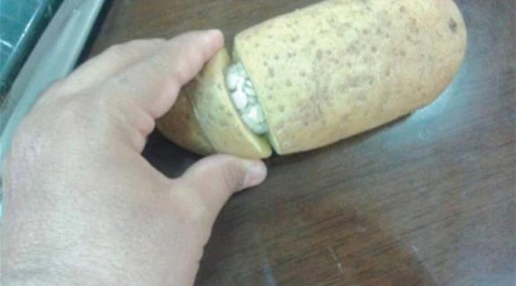 صورة: ماذا وجد هذا المواطن السعودي داخل ثمرة بطاطس؟