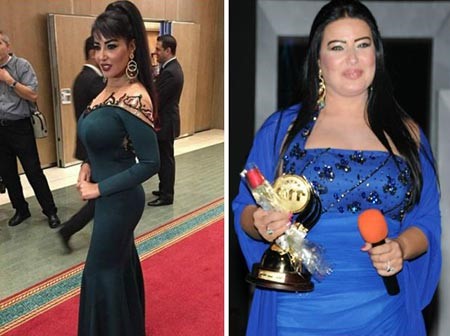 6- سمية الخشاب بسبب الكرتزون على حسب قولها