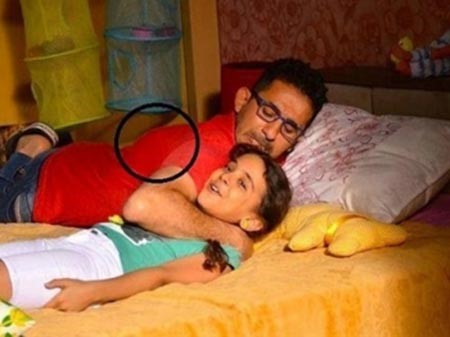 نشطاء يتداولون صورة لورم في ظهر أحمد حلمي
