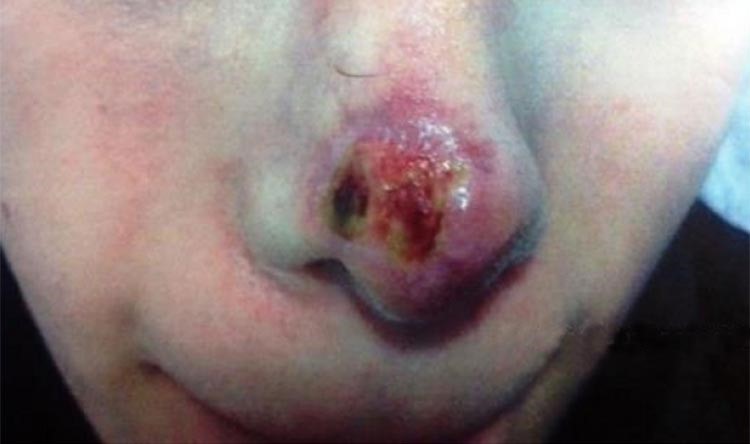 فيديو وصور صادمة لعمليات تجميل فاشلة في لبنان وفضحها وزير الصحة اللبناني