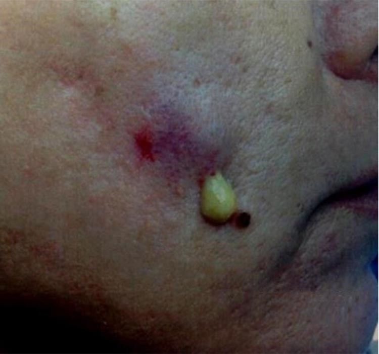 فيديو وصور صادمة لعمليات تجميل فاشلة في لبنان وفضحها وزير الصحة اللبناني