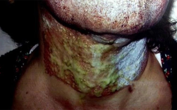 فيديو وصور صادمة لعمليات تجميل فاشلة في لبنان وفضحها وزير الصحة اللبناني