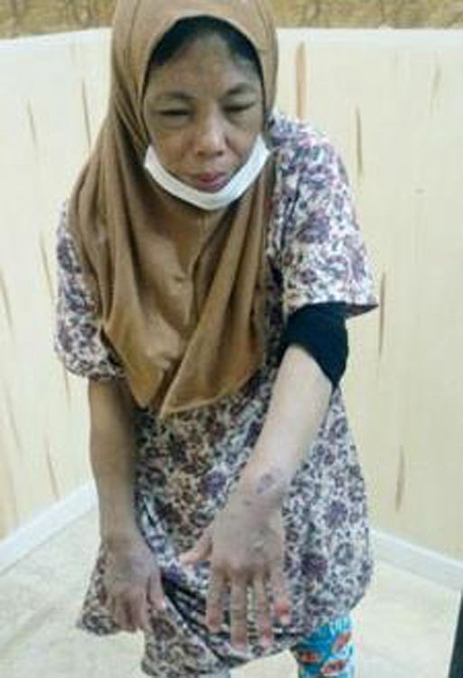 بالصور.. عاملة إندونيسية في السعودية تقفز إلى شقة الجيران هرباً من تعذيب الكفيل