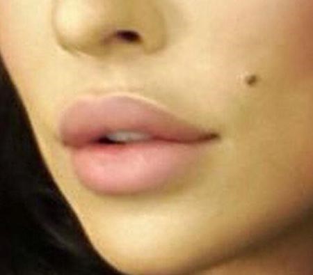 نادين نجيم تدافع عن عملية تجميل شفتيها بصورة.. شاهدها
