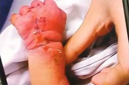 بالفيديو.. أم تلتهم رضيعها فور ولادته! والعناية الالهية تنقذه