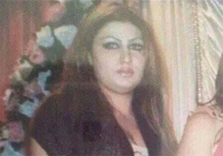 صورة مسرّبة: لن تعرف هذه النجمة قبل عمليات التجميل!