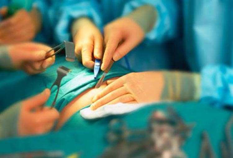 شاب سعودي يُجري عملية تجميل قُبيل زفافه فتتسبب بتدهور وضعه الصحي