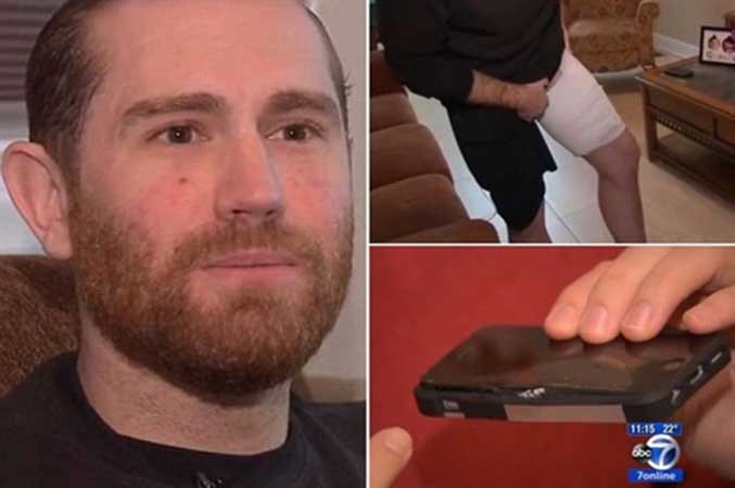 بالفيديو..  انفجار آيفون 5 يسبب لصاحبه حروقا من الدرجة الثالثة