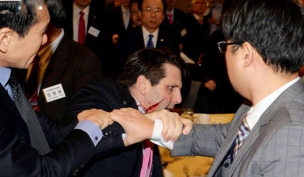 بالفيديو.. لحظة الاعتداء على السفير الأميركي في كوريا الجنوبية بسكين مطبخ وإصابته بجرح 80 غرزة