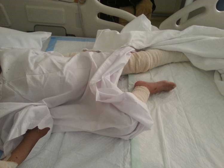 خادمة في الشارقة تحرق طفلاً بمادة كاوية 