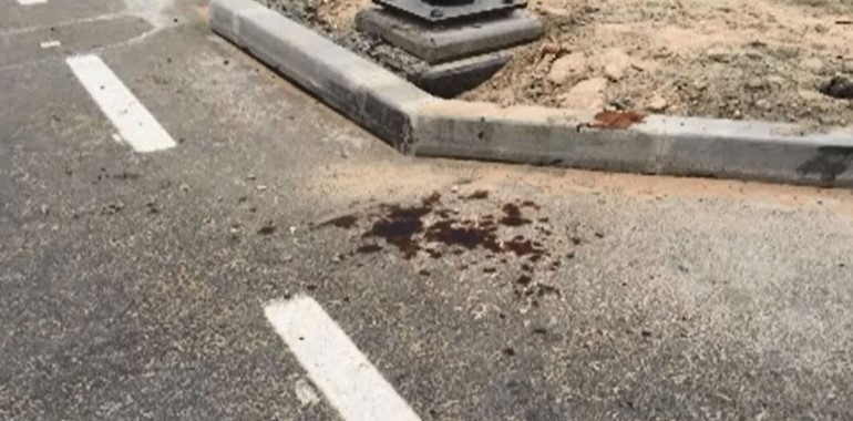 بالصور.. مقتل شاب اماراتي طعناً بالسيوف والسوائل الحارقة 