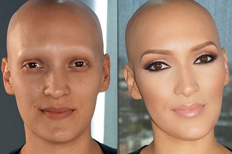 بالصور.. شابة مصابة بمرض alopecia.. شاهد كيف غيرها المكياج لتزيد التوعية