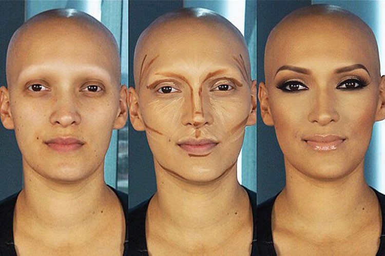 بالصور.. شابة مصابة بمرض alopecia.. شاهد كيف غيرها المكياج لتزيد التوعية
