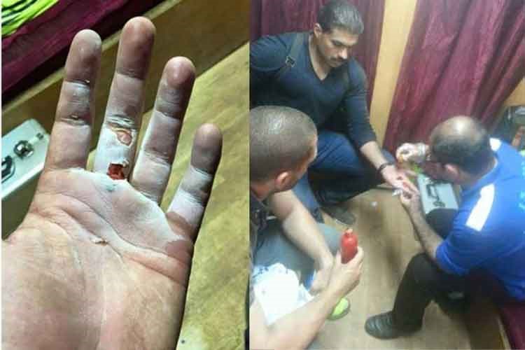 بالصور.. إصابة خالد سليم أثناء التصوير