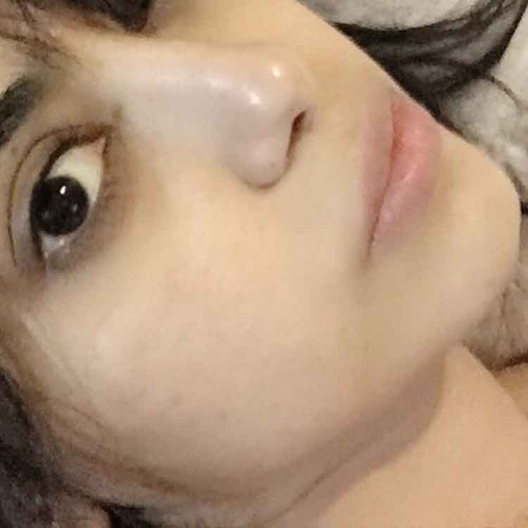 صورة: شيلاء سبت تعاني من انتفاخ عينيها.. وتطلب من جمهورها حل سريع