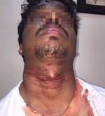 اثار النحر تبدو على رقبة الاسيوي
